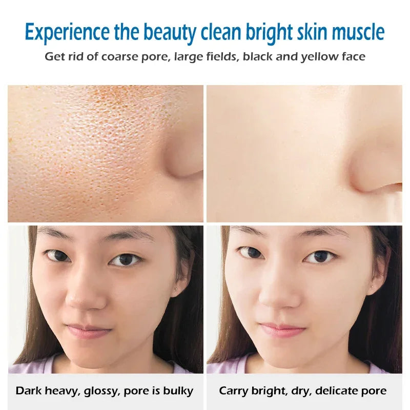 Sea Salt Soap Bar - Whitening and Moisturizing Face and Body Cleanser for Acne Treatment