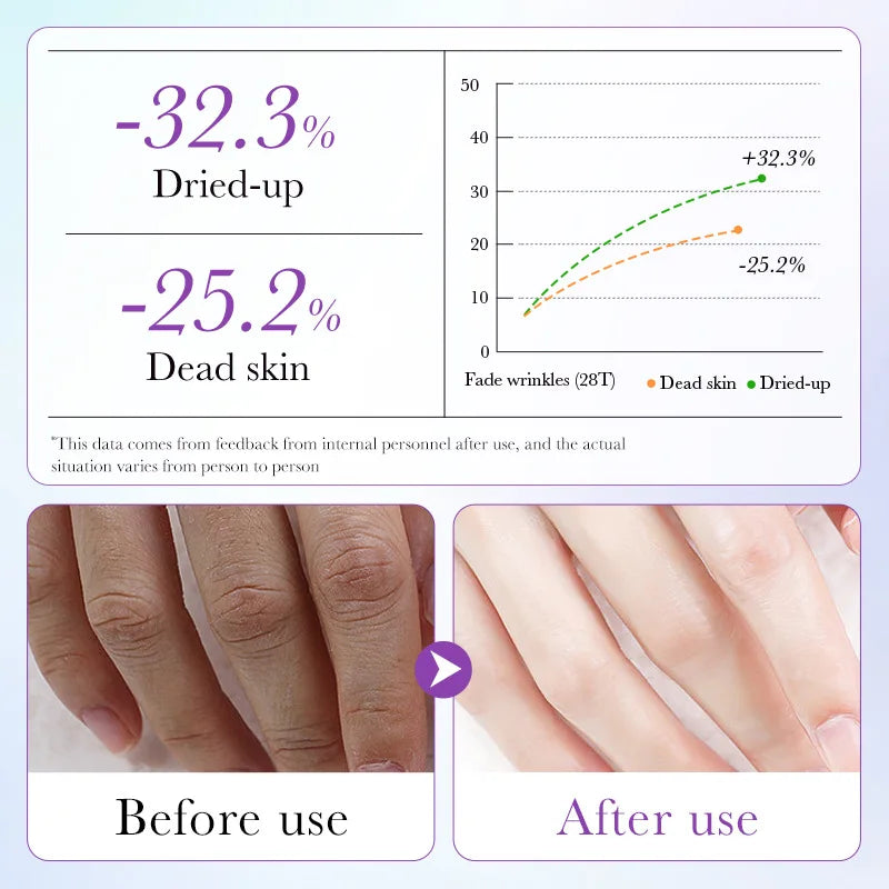 Lavender Hand Mask Spa Gloves - Moisturizing & Exfoliating Treatment (5 Pack)