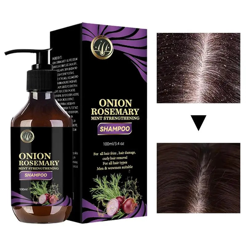 Rosemary & Onion Hair Growth Shampoo - Thickening & Volumizing Treatment (500ml)