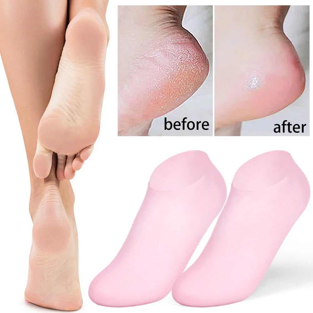 1 Pair Silicone Moisturizing Foot Socks - Spa Pedicure Gel Socks for Dry Cracked Feet