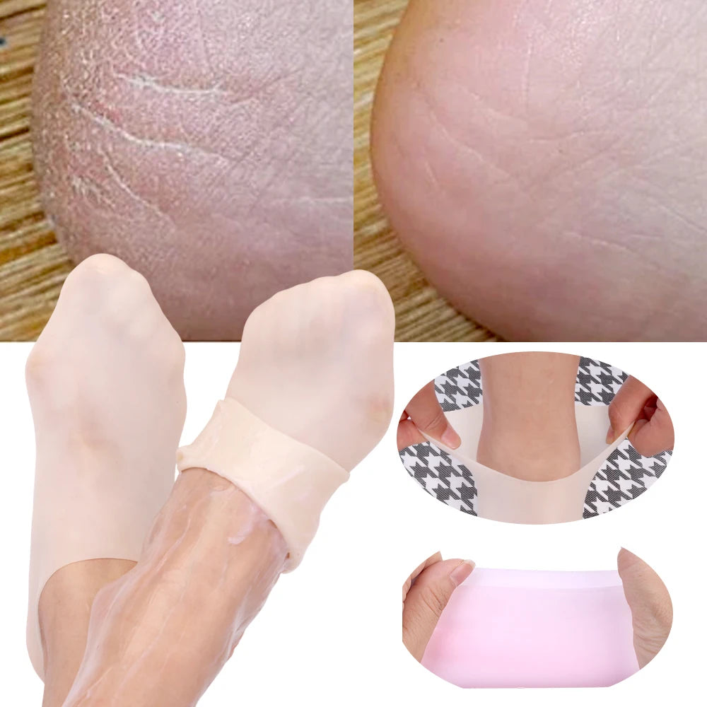 1 Pair Silicone Moisturizing Foot Socks - Spa Pedicure Gel Socks for Dry Cracked Feet