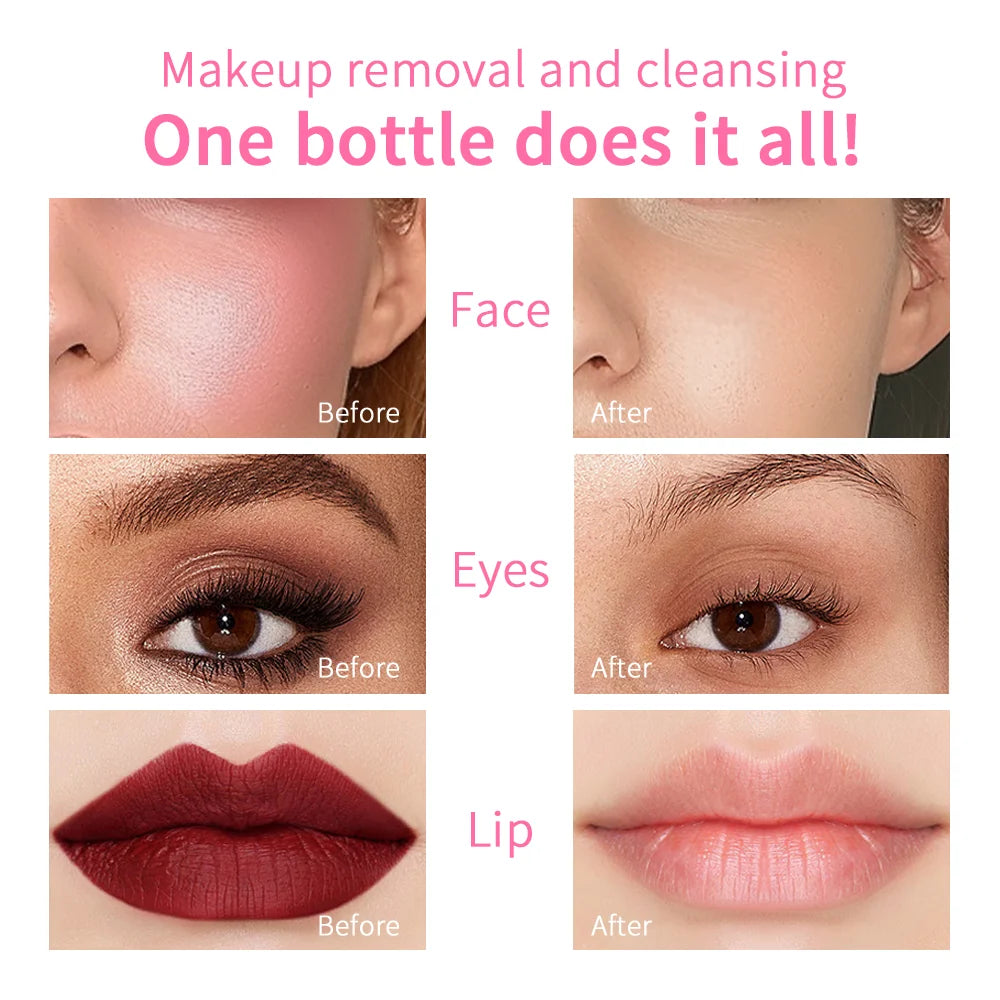 100ml Garnier Micellar Water - Hydrating Facial Cleanser and Deep Makeup Remover